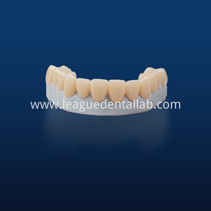 Full Zirconia crown,Full contour zirconia,Solid Zirconia,Zirconia,Monolithic Zirconia